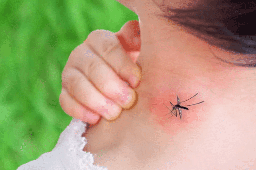 disinfestare zanzare